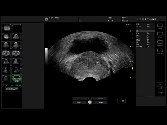 GE Versana Essential