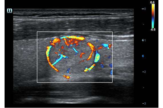 Mindray DC-60 Exp X-Insight